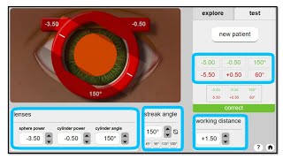 Retinoscopy Simulator Practice Retinoscopy with Simulator [upl. by Hanway]