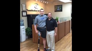 Above Knee Amputee from Lithuania to Prosthetics In Motion NYC [upl. by Firman]