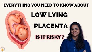 What is low lying placenta   Can Low Lying Placenta be dangerous to baby  Placenta previa [upl. by Enirbas]