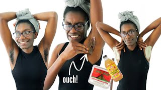 I tried DIY sugar waxing my armpits for the first time 😳  ARMPIT DETOX  WAX FAIL [upl. by Edmund507]