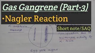 Nagler Reaction  Gas gangrenePart3  Short noteSAQ [upl. by Lachus87]