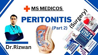 Peritonitis Part 2SurgeryMS MedicosDr RizwanUrdu Hindi Easy Explanations [upl. by Will513]