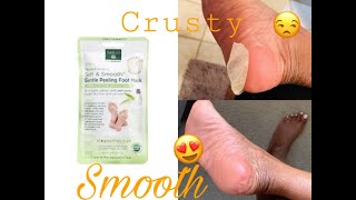 I TRIED A FOOT PEEL MASK  FOOT CARE [upl. by Assilaj]