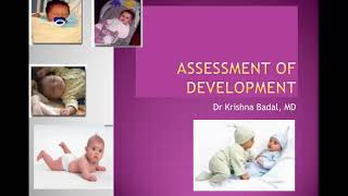 Assessment of development in a child [upl. by Koblick]