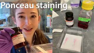 Ponceau staining  what why amp how with some practical tips [upl. by Levona378]