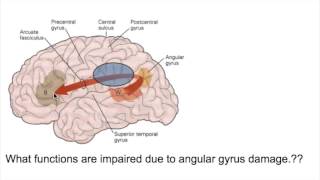 PROSOPAGNOSIA Face blindnessANGULAR GYRUS LESIONS [upl. by Holcomb]