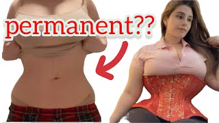 ARE CORSET RESULTS PERMANENT [upl. by Charbonneau]