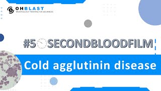 50SecondBloodFilm Cold agglutinin disease [upl. by Thay]