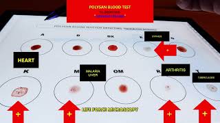 Whats Hiding in Your BLOOD TEST Results [upl. by Goerke]