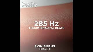 285 Hz Binaural Beats  Skin Burns Healing [upl. by Nnaasil363]