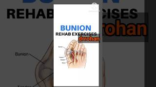 Bunion Rehab exercise [upl. by Ahsieyk]