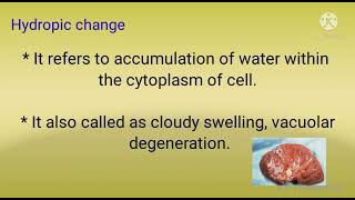 Hydropic change pathology  morphology of reversible cell injury part1 [upl. by Valentia]