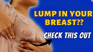 What you need to know about BREAST LUMPS [upl. by Violante858]