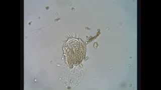 Ciliate excystment  A Stylonychia is reborn [upl. by Yenitsed214]