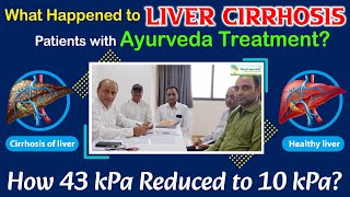 What Happened to Liver Cirrhosis Patients with Ayurveda Treatment How 43 kPa Reduced to 10 kPa [upl. by Artinad361]