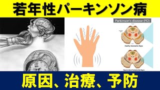 若年性パーキンソン病（10代、20代でも発症）の症状から治療について解説します [upl. by Aiyot665]