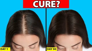 Womens Hair Loss Treatments That ACTUALLY WORK [upl. by Avrit185]