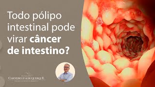 Todo pólipo intestinal pode virar câncer de intestino  Prof Dr Luiz Carneiro CRM 22761 [upl. by Darlleen]