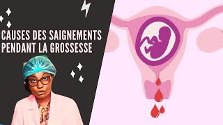 Causes des saignements pendant la grossesse [upl. by Waki]