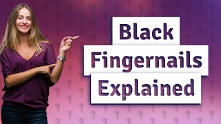 What is a black fingernail [upl. by Abigael108]