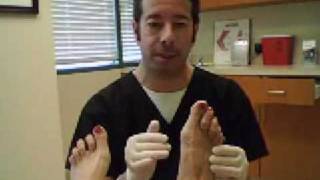 Bunions by Dr Leo Krawetz Understanding Bunions [upl. by Ennairrac]