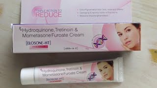 Elosone Ht Cream Benefit amp Hydroquinone amp Tretinoin amp Mometasone Cream Uses [upl. by Menard377]