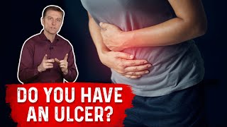 Understanding Ulcers How Do You Know If You Have One – Dr Berg [upl. by Burg]