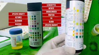 Ultimate Guide to Using 10 Parameter Urine Test Strips  2024 [upl. by Declan]