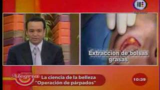 Dr Jaime Rodriguez Sierra Blefaroplastia Venga la Alegria Crugia Plastica [upl. by Berthoud]