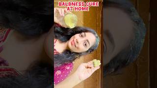 Baldness Cure at Home 🏠 shortsfeedshortsviralviralshort diyhairbaldnessbaldfemalehairloss [upl. by Ulda]