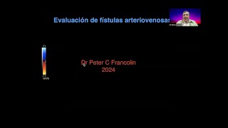 28 Evaluación de fístulas para hemodiálisis  Dr Francolin [upl. by Aissirac]