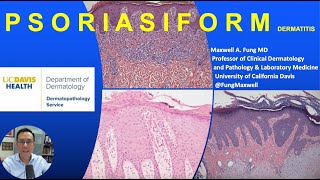 DERMATOPATHOLOGY Psoriasiform Dermatitis [upl. by Mirna]