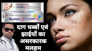 Ointment for melasma। Reetor HC ointment review Hydroquinone Tretinoin amp Mometasone cream। uses। [upl. by Adnowal]