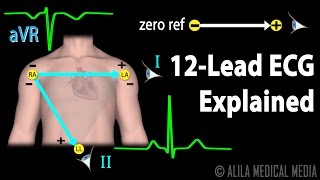 12 Lead ECG Explained Animation [upl. by Christa]