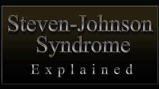 StevensJohnson Syndrome Explained Doctor Tutorial [upl. by Kone802]