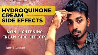 Hydroquinone Side effects  Skin lightening cream side effects drthamizhinian skinlightening [upl. by Quiteria]