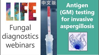 Aspergillus antigen galactomannan  fungal diagnostics webinar with QampA invasive aspergillosis [upl. by Dobb]