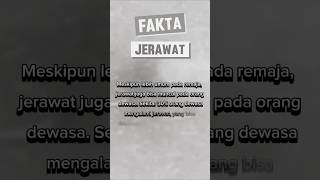 Fakta Jerawat [upl. by Cadell]