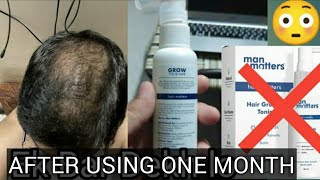 After using one month  Man Matters Hair Tonicl  DHT Blocker  Manmatters Anti hairfall shampoo [upl. by Nnahgem]