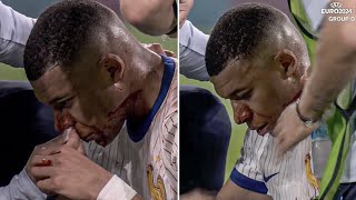 Kylian Mbappe INJURY vs Austria  France vs Austria Euro 2024 [upl. by Imled]