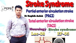 Stroke syndrome  TACS amp PACS by Dr Raghib Asfak  Neurology Lec08 Easy amp Bangla Explanation [upl. by Waal]