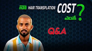 how much cost for my hair transplant  question ampanswers  what is hair transplant  hair transplant [upl. by Debbra]