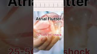 NEETPG 🩺 FMGE preparation  Cardiology short fmge neetpg studyvlog [upl. by Sualkcin]