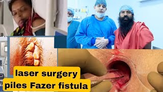 बाबा रामदेव  पतंजलि योगपीठ मे मेरी surgery हो गयी है laser surgery fisher piles Patanjali [upl. by Temme]