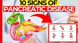 10 Signs Of Pancreatic Disease That We Ignore [upl. by Lisk]