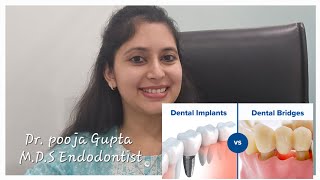 Dental Implant Vs Dental BridgeFixed Treatment option for missing teethDr Pooja Gupta [upl. by Dannel]