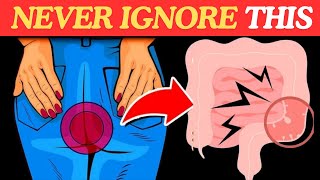 Colon Cancer Symptoms  Colorectal Cancer  10 warning signs of Colon Cancer  Colon Cancer [upl. by Colp]