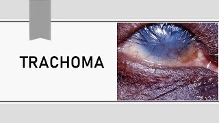 Trachoma Lecture [upl. by Danella458]