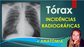 Vídeo Aula 18 Tórax Incidências Radiográficas  Anatomia [upl. by Nerahs676]