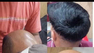 Hair Patch l Hair Work l hair youtubeshorts viralvideo unisexbeautyandhairsaloon [upl. by Figone]